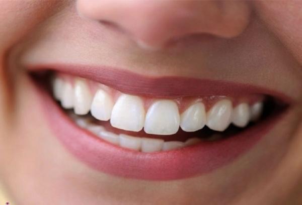 دلیل بوجود آمدن لکه های سفید روی دندان چیست؟